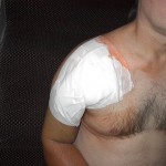 Poofy Bandage Photo